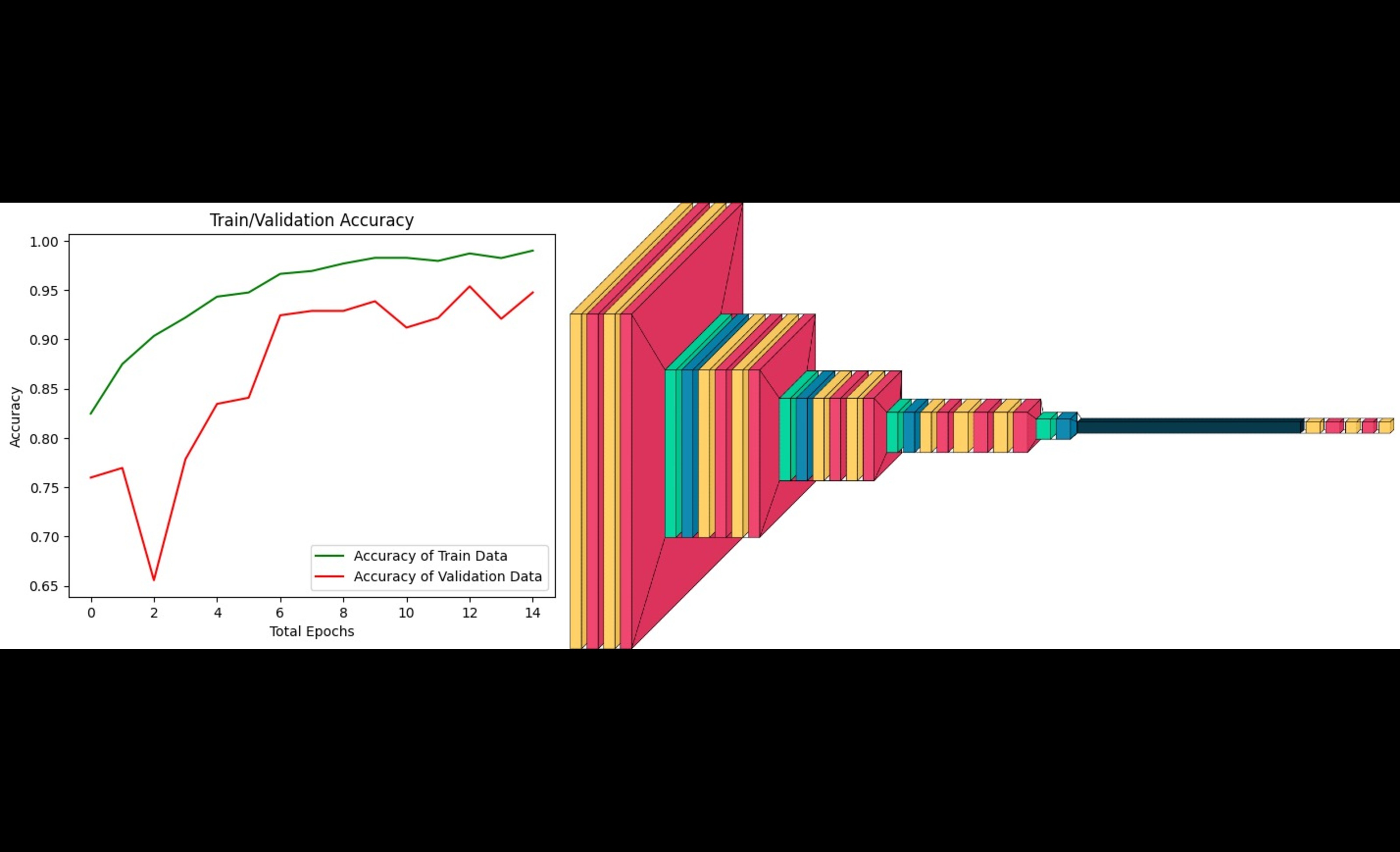 Brain Tumor Detection